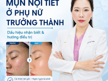 Mụn nội tiết ở phụ nữ trưởng thành: dấu hiệu và điều trị tại Thủ Dầu Một