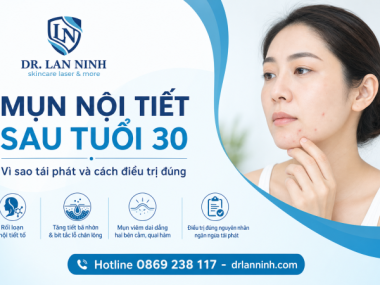 MỤN NỘI TIẾT SAU TUỔI 30: VÌ SAO TÁI PHÁT VÀ CÁCH ĐIỀU TRỊ
