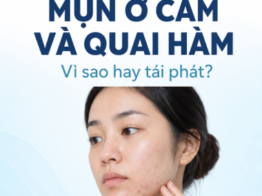 MỤN Ở CẰM VÀ QUAI HÀM: VÌ SAO TÁI PHÁT VÀ KHÁM Ở THỦ DẦU MỘT