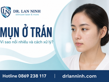 MỤN Ở TRÁN: VÌ SAO NỔI NHIỀU VÀ CÁCH XỬ LÝ Ở THỦ DẦU MỘT