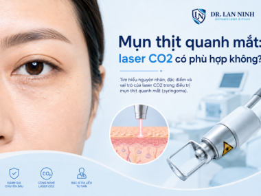 Mụn thịt quanh mắt: khi nào nên cân nhắc laser CO2?