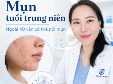 Mụn tuổi trung niên: Vì sao ngoài 40 vẫn bị mụn?