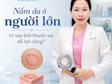 Nấm da ở người lớn tại Thủ Dầu Một: vì sao bôi thuốc sai dễ lan rộng?