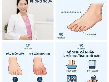 Nấm Kẽ Chân: Dấu Hiệu Sớm Và Cách Tránh Lây Trong Nhà