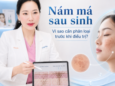 Nám má sau sinh tại Thủ Dầu Một: vì sao cần phân loại trước khi điều trị?