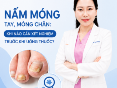 Nấm Móng Tay Móng Chân: Khi Nào Cần Xét Nghiệm?