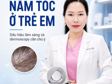Nấm tóc ở trẻ em tại Bình Dương: dấu hiệu lâm sàng và dermoscopy cần chú ý