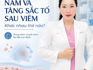 Nám và tăng sắc tố sau viêm khác nhau thế nào ở Thủ Dầu Một?