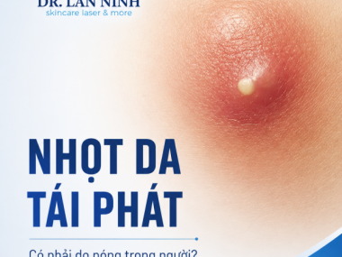 Nhọt da tái phát: có phải do nóng trong người?