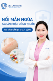 Nổi mẩn ngứa sau ăn hoặc uống thuốc
