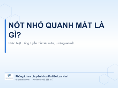 NỐT NHỎ QUANH MẮT: PHÂN BIỆT U ỐNG TUYẾN MỒ HÔI, MILIA, U VÀNG