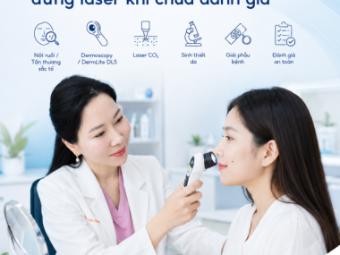 Nốt ruồi ở mặt muốn xóa: vì sao chưa nên laser ngay?