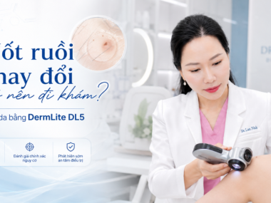 Nốt ruồi thay đổi màu hoặc kích thước: khi nào cần khám da liễu tại Bình Dương?