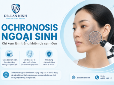 OCHRONOSIS NGOẠI SINH: KEM LÀM TRẮNG KHIẾN DA SẠM ĐEN