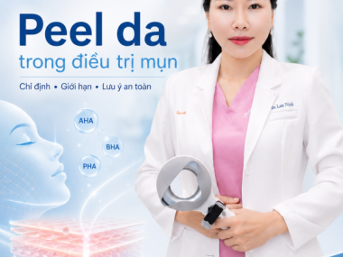 Peel da điều trị mụn tại Thủ Dầu Một: chỉ định và lưu ý an toàn