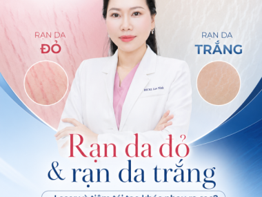 Rạn da đỏ và rạn da trắng: laser và tiêm tái tạo tại Bình Dương