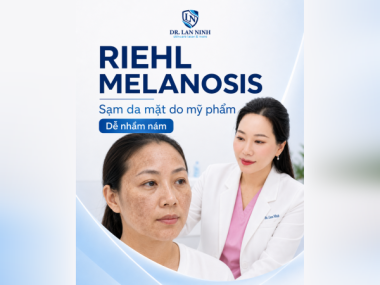 RIEHL MELANOSIS: SẠM DA MẶT DO MỸ PHẨM DỄ NHẦM NÁM