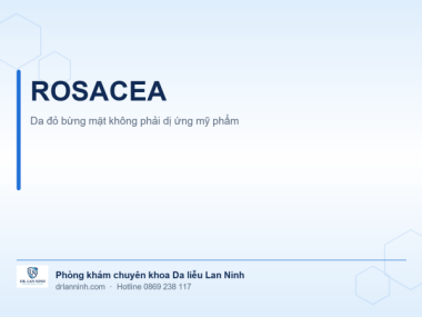ROSACEA: DA ĐỎ BỪNG MẶT KHÔNG PHẢI DỊ ỨNG MỸ PHẨM