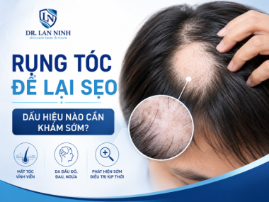 Rụng tóc để lại sẹo: Dấu hiệu cần khám sớm tại Thủ Dầu Một