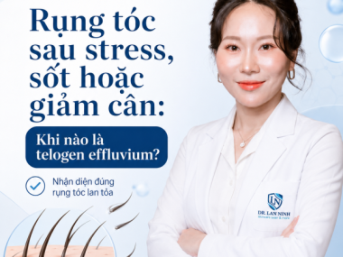 Rụng tóc sau stress: khi nào là telogen effluvium?