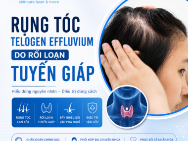 RỤNG TÓC TELOGEN EFFLUVIUM DO RỐI LOẠN TUYẾN GIÁP