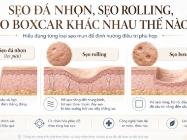 Sẹo đá nhọn, sẹo rolling, sẹo boxcar khác nhau thế nào?