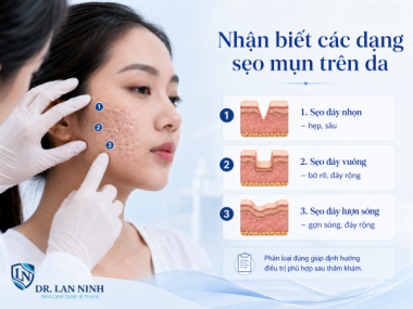 Sẹo đáy nhọn, đáy vuông và đáy lượn sóng khác nhau thế nào?