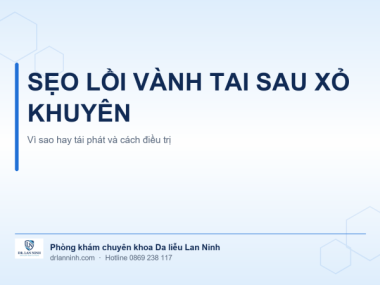 SẸO LỒI VÀNH TAI SAU XỎ KHUYÊN: VÌ SAO HAY TÁI PHÁT