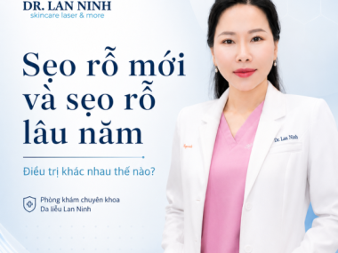 Sẹo rỗ mới và sẹo rỗ lâu năm tại Thủ Dầu Một: điều trị khác nhau thế nào?