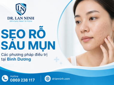 SẸO RỖ SAU MỤN: CÁC PHƯƠNG PHÁP ĐIỀU TRỊ TẠI BÌNH DƯƠNG
