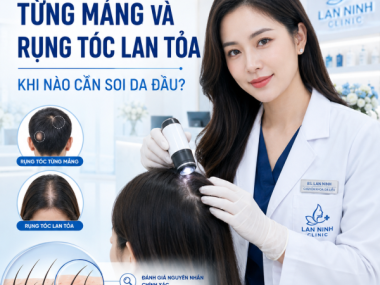 Soi da đầu khi rụng tóc tại Thủ Dầu Một: phân biệt rụng tóc từng mảng và lan tỏa