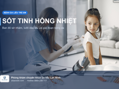 SỐT TINH HỒNG NHIỆT: BAN ĐỎ NHÁM, LƯỠI DÂU TÂY VÀ BONG DA