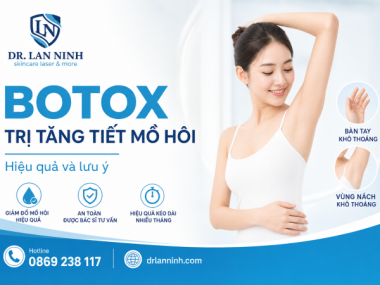 TIÊM BOTOX ĐIỀU TRỊ TĂNG TIẾT MỒ HÔI: HIỆU QUẢ VÀ LƯU Ý