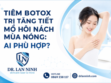 TIÊM BOTOX TRỊ TĂNG TIẾT MỒ HÔI NÁCH MÙA NÓNG: AI PHÙ HỢP?