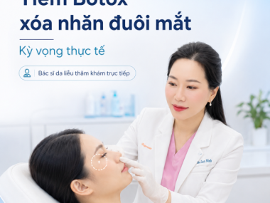 Tiêm Botox xóa nhăn đuôi mắt tại Bình Dương: Kỳ vọng & lưu ý