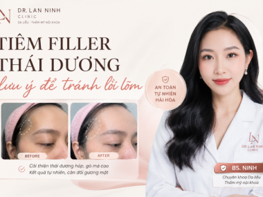 Tiêm filler thái dương: lưu ý để tránh lồi lõm