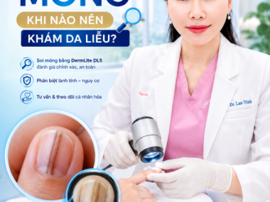 Tổn thương móng có vệt sắc tố ở Thủ Dầu Một: khi nào nên khám da liễu?