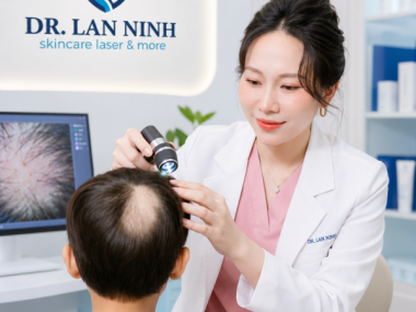 Trẻ rụng tóc từng mảng: khi nào cần soi da đầu?