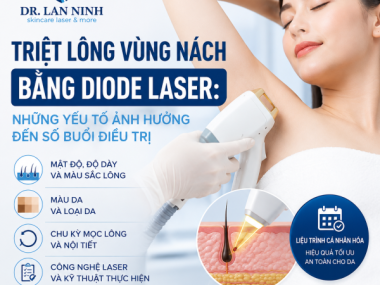 Triệt lông nách diode laser: Yếu tố ảnh hưởng số buổi