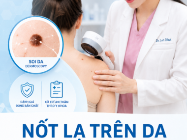 U da lành tính và ác tính ở Bình Dương: Vì sao không nên tự đốt nốt lạ?