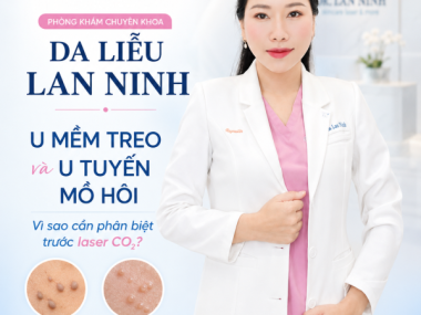 U mềm treo và u tuyến mồ hôi: vì sao cần phân biệt trước laser CO2 tại Bình Dương?