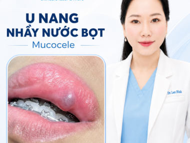 U NANG NHẦY MÔI DƯỚI Ở NGƯỜI NIỀNG RĂNG: CHẨN ĐOÁN VÀ XỬ TRÍ