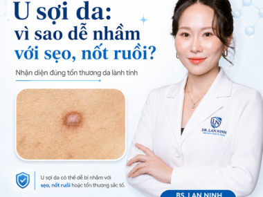 U sợi da: vì sao dễ nhầm với sẹo, nốt ruồi?