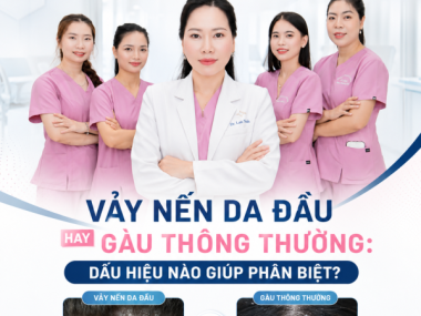 Vảy nến da đầu hay gàu? Dấu hiệu phân biệt tại Bình Dương