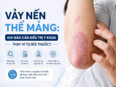 Vảy nến thể mảng: khi nào cần điều trị y khoa?