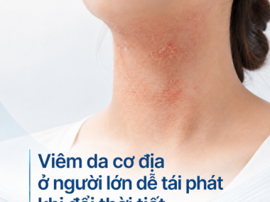 Viêm da cơ địa ở người lớn dễ tái phát khi đổi thời tiết