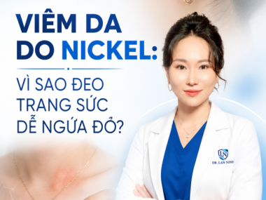 VIÊM DA DO NICKEL: VÌ SAO ĐEO TRANG SỨC DỄ NGỨA ĐỎ?