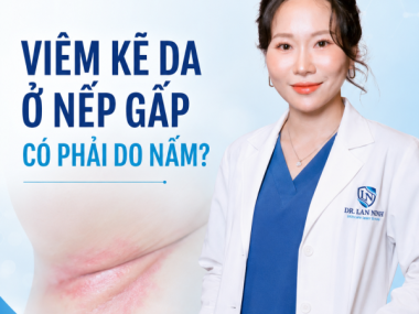 VIÊM KẼ DA: HĂM ĐỎ Ở NẾP GẤP CÓ PHẢI DO NẤM?
