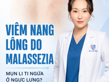 VIÊM NANG LÔNG DO MALASSEZIA: MỤN LI TI NGỨA Ở NGỰC LƯNG