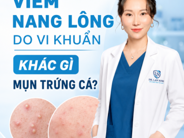 VIÊM NANG LÔNG DO VI KHUẨN KHÁC GÌ MỤN TRỨNG CÁ?